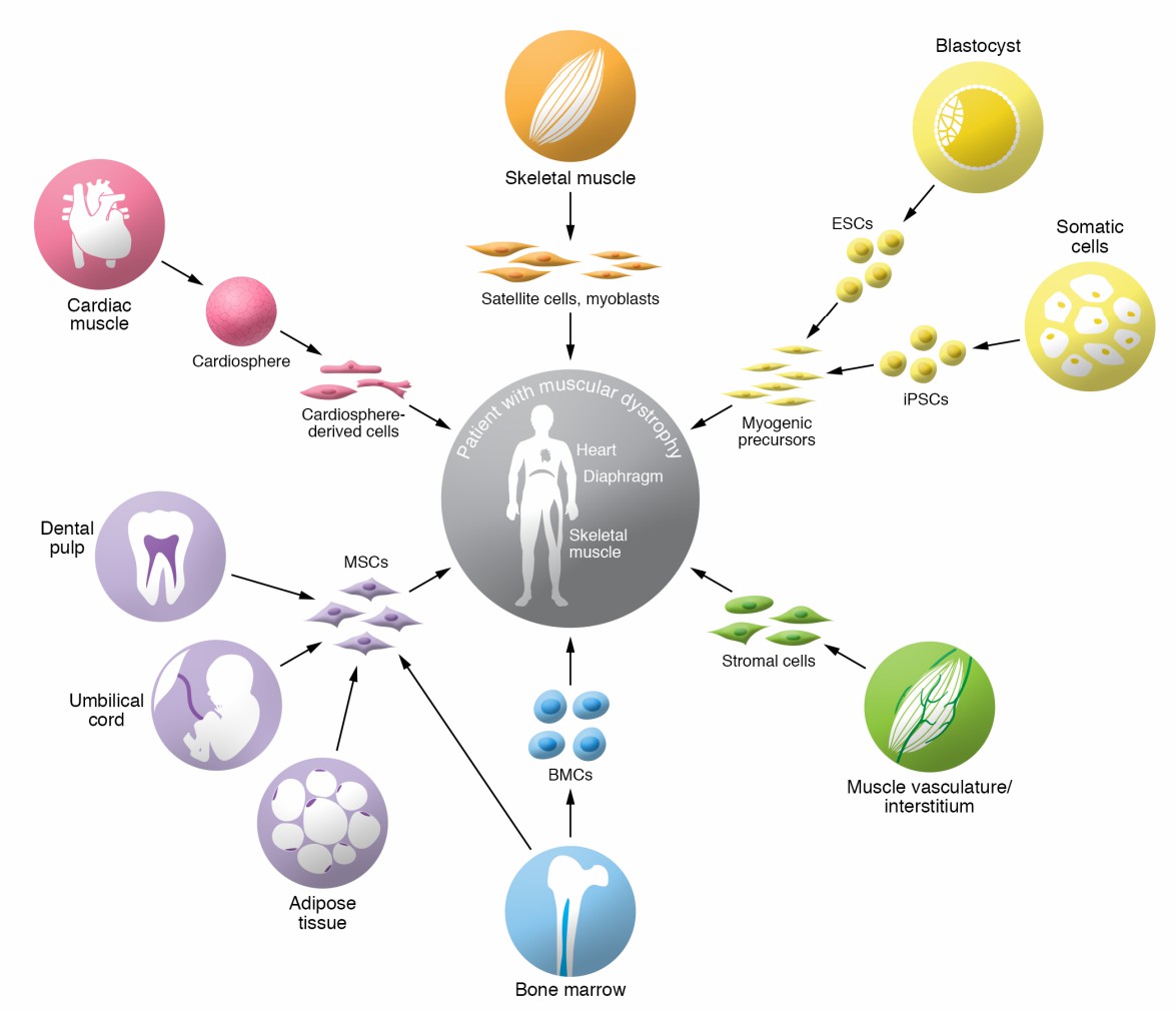 Overview of candidate cell types for cell therapy in muscular dystrophies.