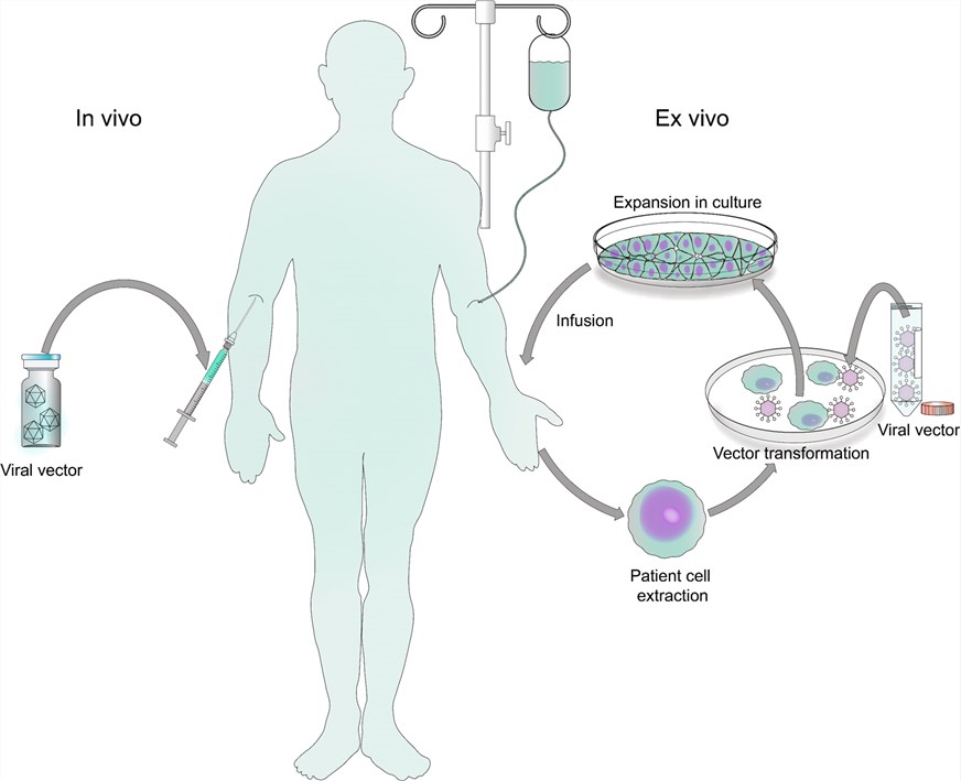 Summary of Viral Gene Therapy Modalities