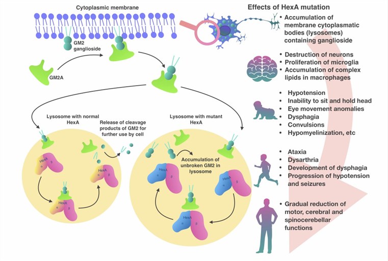 Pathogenesis of Tay-Sachs disease