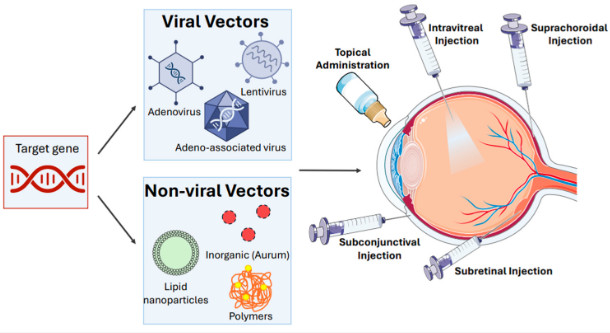 Figure 1. Types of targeted gene delivery for gene therapy of ocular diseases. (OA Literature)