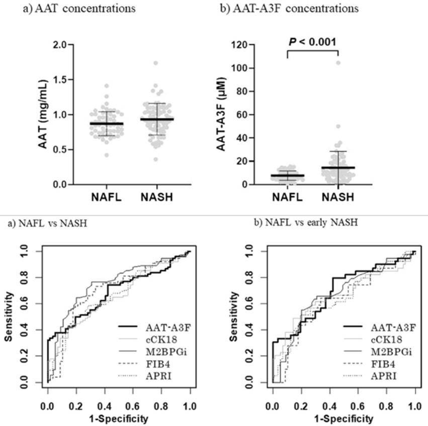 Diagnostic performance of AAT-A3F for NASH.