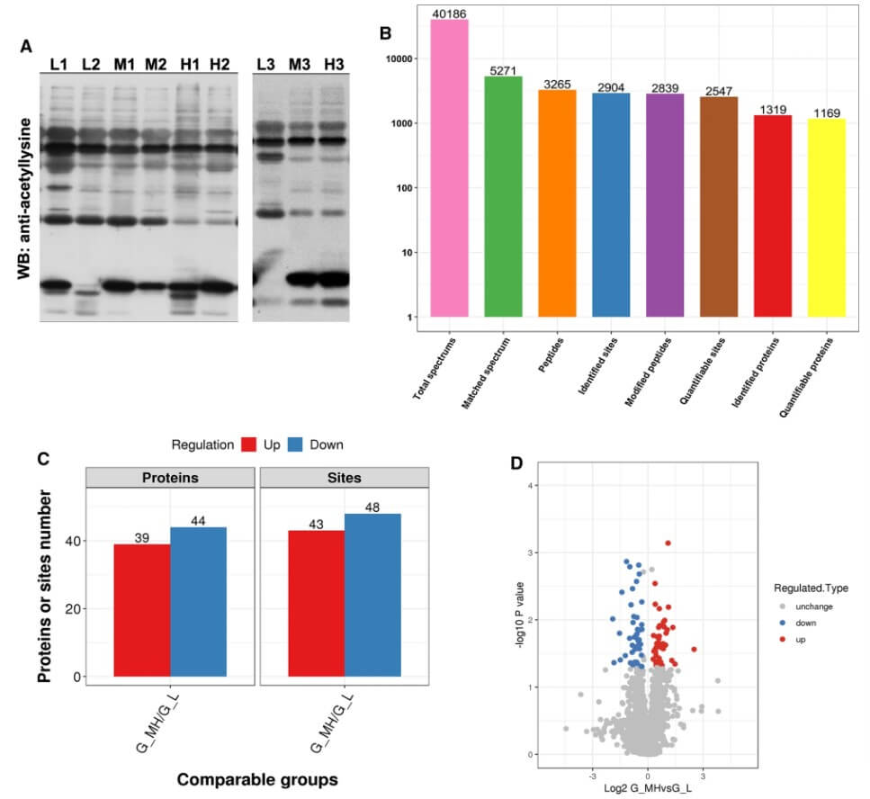 Fig. 1. Distribution of acetylated proteins identified in GIST. (OA Literature)