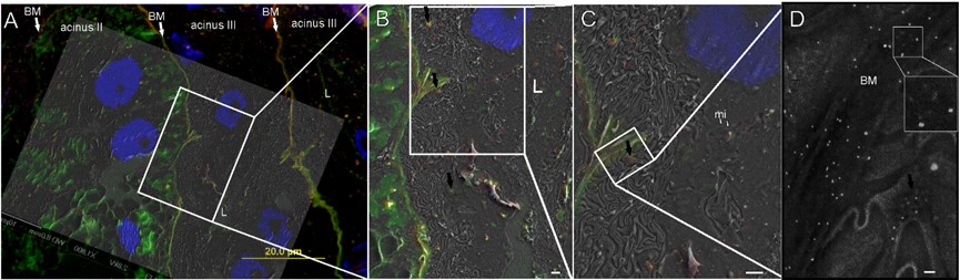 Application of fluorescence combined with SEM technology in tick salivary gland sections. (OA Literature)
