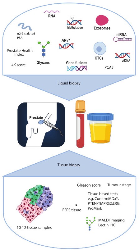 Fig. 1. Methods for biopsy analysis of PCa. (OA Literature)
