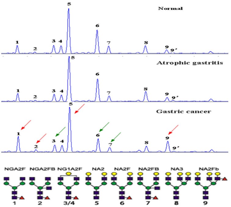 Fig. 2. Desialylated N-glycan profiling results in samples from different groups. (OA Literature)