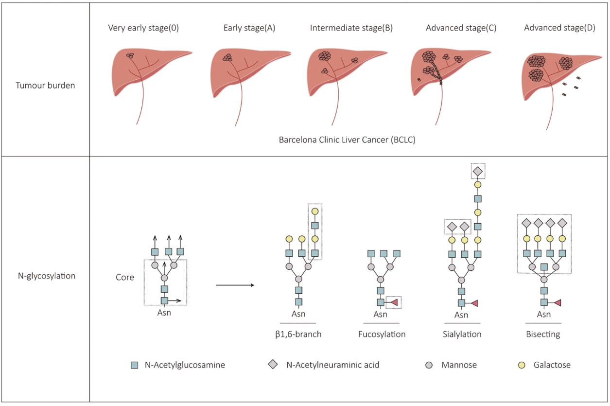 Fig. 1. Hepatocellular carcinoma progression and N-glycans change. (OA Literature)