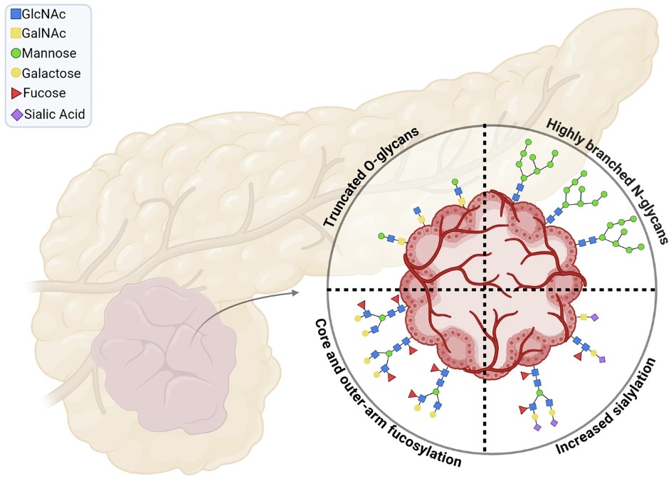 Fig. 1. Glycosylation changes observed in pancreatic ductal adenocarcinoma. (OA Literature)