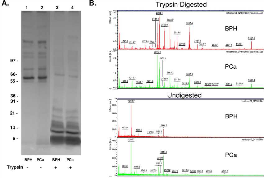 Fig.2 Analysis procedures for Con A binding to serum glycoproteins.