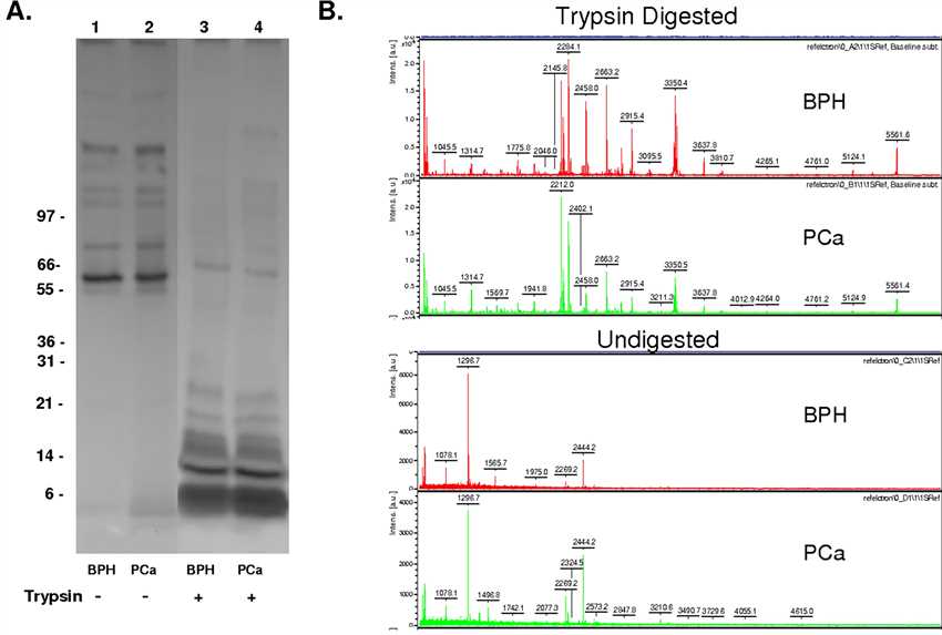 Con A-bound serum glycoproteins digested with trypsin prior to MALDI-TOF 