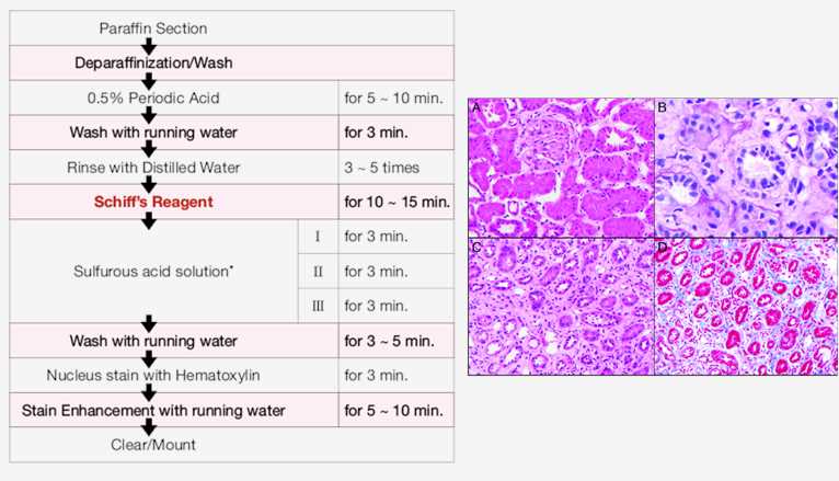 Workflow of PAS staining and PAS histological stain results.