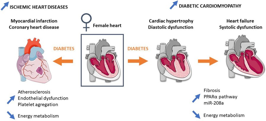 Fig.1 Mechanisms involved in ischemic heart diseases and diabetic cardiomyopathy.