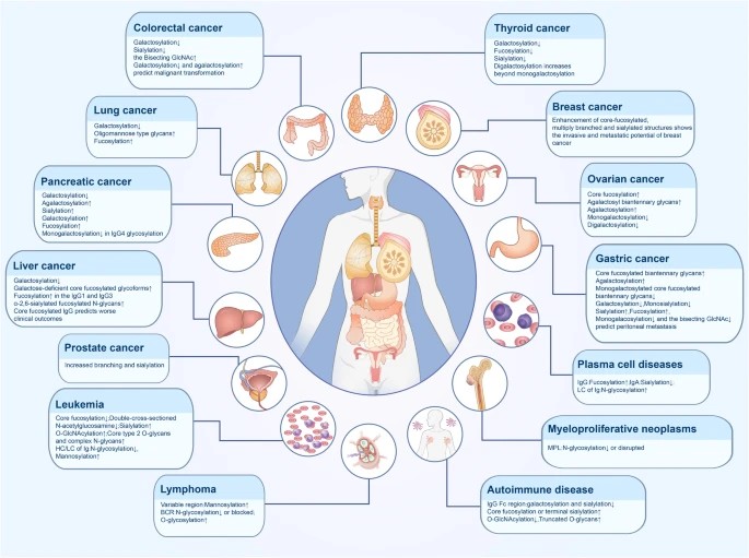 Fig.1 Glycosylation alterations found in various human disease. (OA Literature)