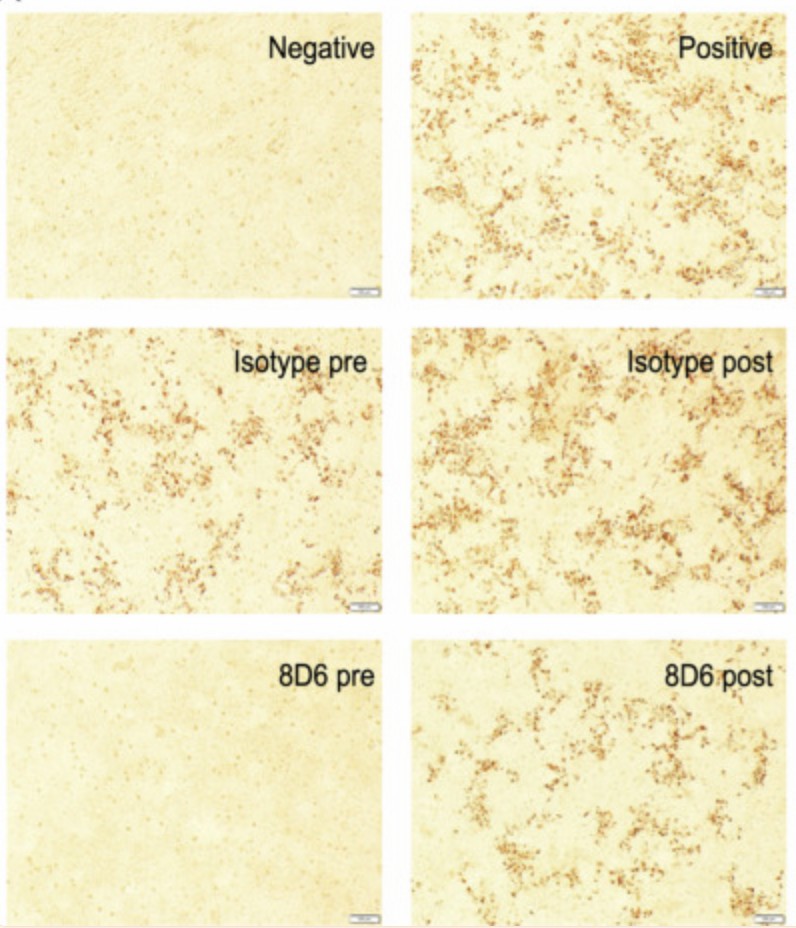 Immuno staining results of a neutralizing monoclonal antibody on HCV infection. (Yi, et al., 2021)