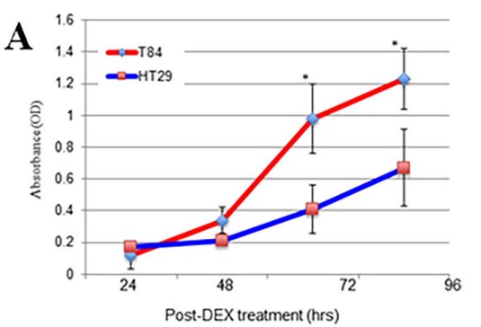 Fig.1 Increased proliferation of metastatic colon carcinoma cells.