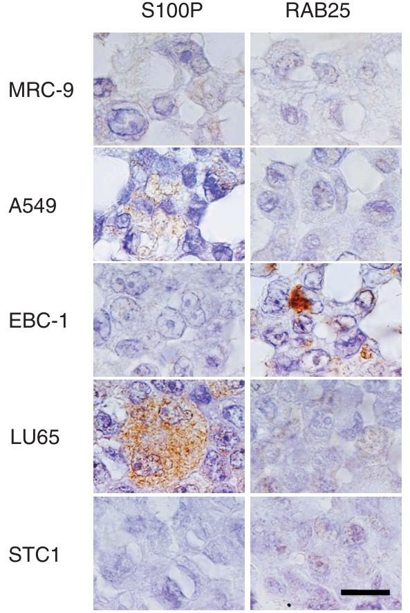 Fig. 1 The expression of two proteins in four lung cancer cells and a normal cell MRC-9.