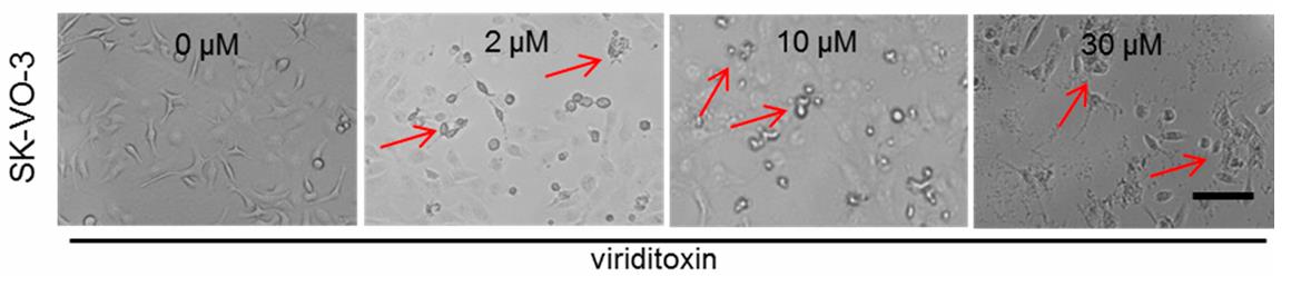 Fig. 1 SK-OV-3 was used as a research model for an ovarian cancer inhibitor.