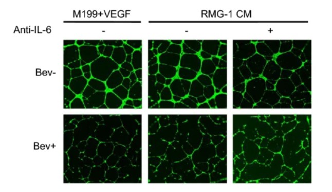 Fig.1 Tube formation of HUVEC. 