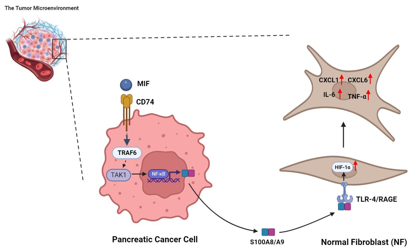 Fig.2 Targeting CD74 suppresses PDAC progression by modulating S100A8/A9 and inflammatory cytokine secretion. (OA Literature)
