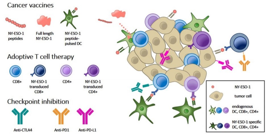 Fig.1 Immunotherapeutic strategies targeting NY-ESO-1 in cancer. (OA Literature)