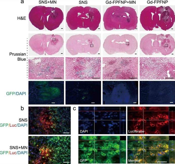 Fig.1 Tumor accumulation of SNS versus Gd-FPFNP in F98 glioma-bearing rats. (OA Literature)