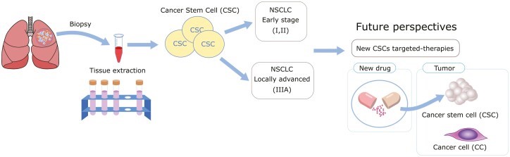 Fig.1 NSCLC evolution and the central role of CSCs in tumor growth and recurrence. (OA Literature)