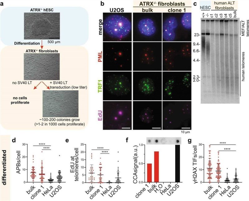 Fig.1 ATRX deficiency triggers the alternative lengthening of telomeres pathway. (OA Literature)