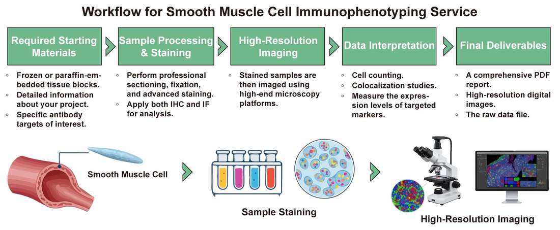 A simple procedure for smooth muscle cell immunophenotyping service. (Creative Biolabs Original)