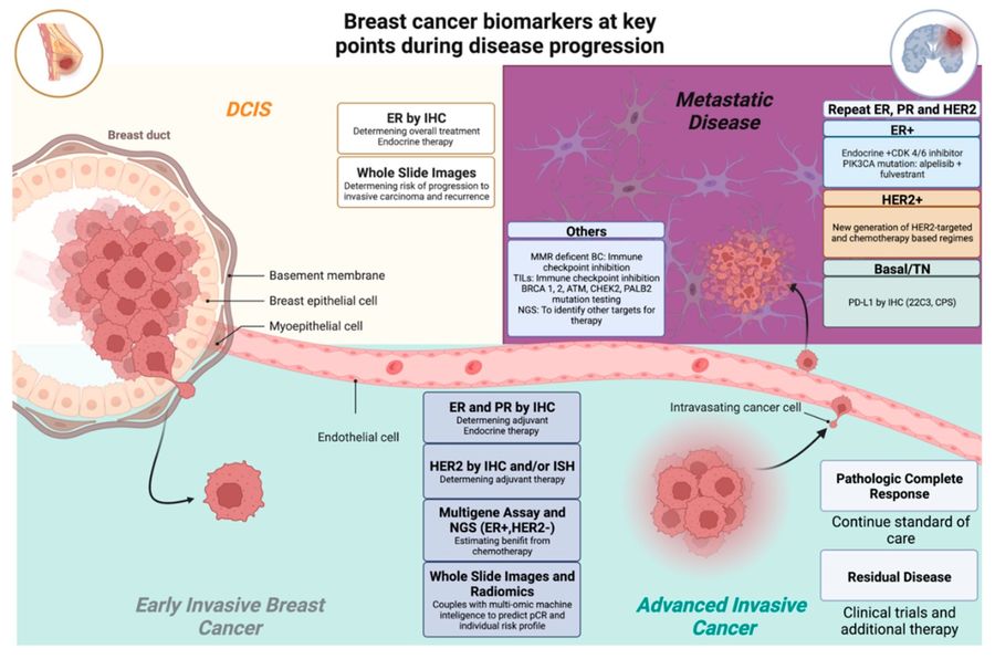 Fig.1 Breast cancer biomarkers at key points during disease progression. (OA Literature)