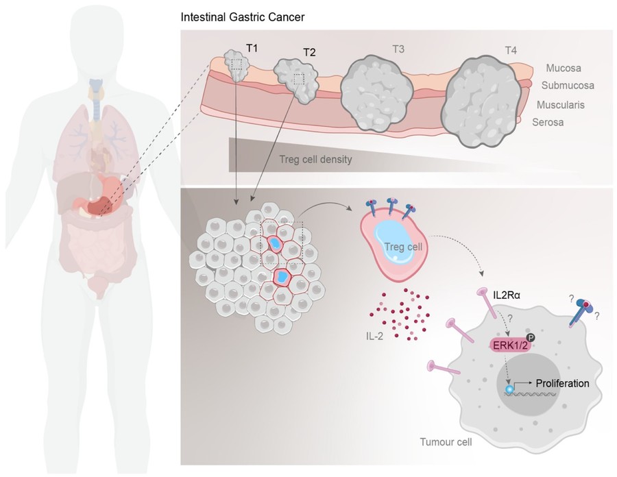Fig.1 Treg prevalence in intestinal-type GC. (OA Literature)