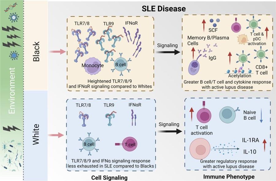 Fig.1 SLE disease. (OA Literature)