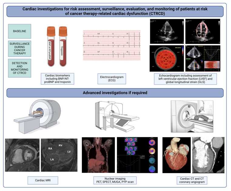 Graphical Depiction of Cardiac Investigations Involved in the Baseline Assessment, Surveillance, and Monitoring of Cancer Patients at Risk of Cancer Therapy-related Cardiac Dysfunction.