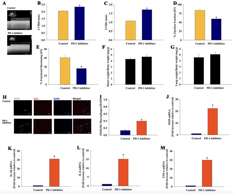 PD-1 Inhibitor Impaired the Heart Function Accompanied by the Inducement of Differentiation of M1 Macrophages.