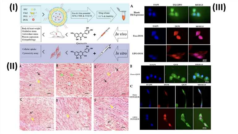 Solid Lipid Nanomedicines in Reducing Cardiotoxicity.