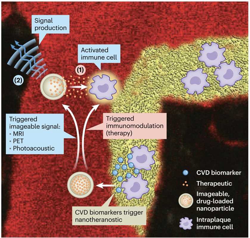 Cardiovascular Nanoimmunotherapy.