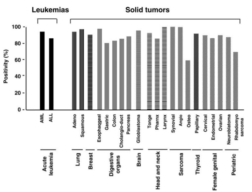 Positivity of WT1 overexpression in various cancers.