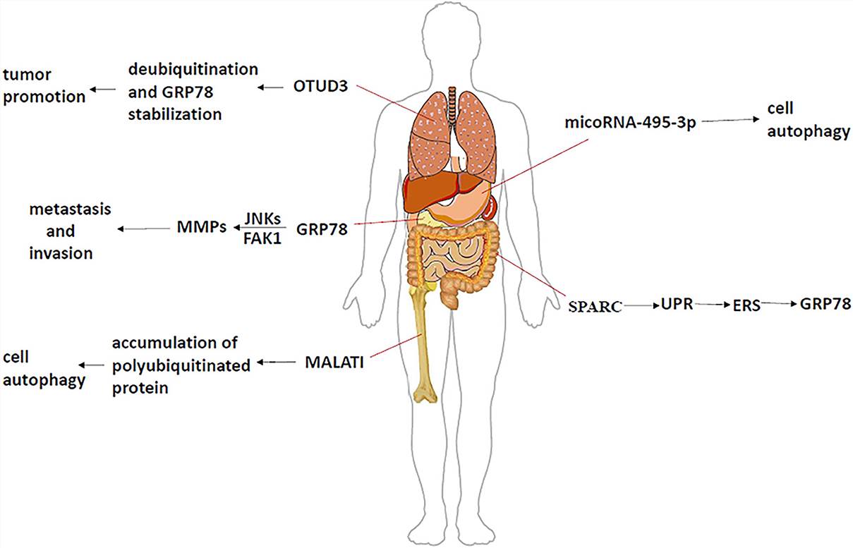 The mechanism of GRP78 in different tumors.