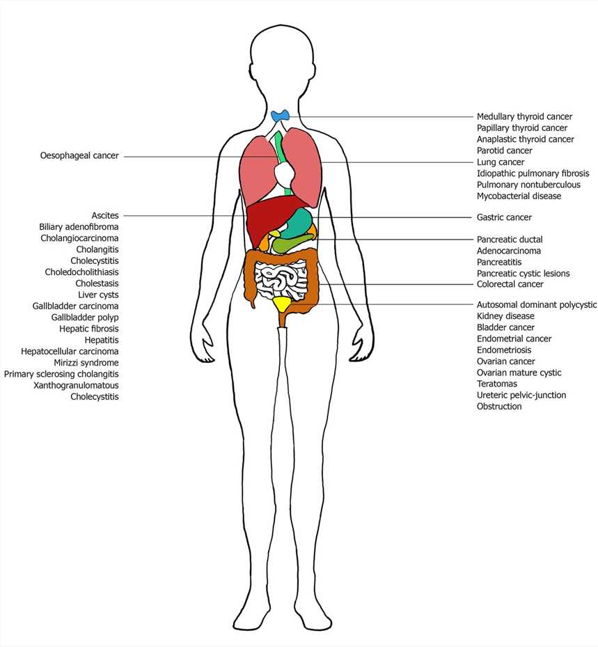 Clinical uses of carbohydrate antigen19-9 based on organ involvement. (Lee, 2020)