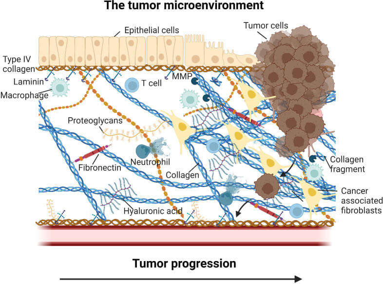 Fig.1 Summary of the cellular, molecular, and extracellular components that define the tumor microenvironment and influence immune dynamics. (OA Literature)
