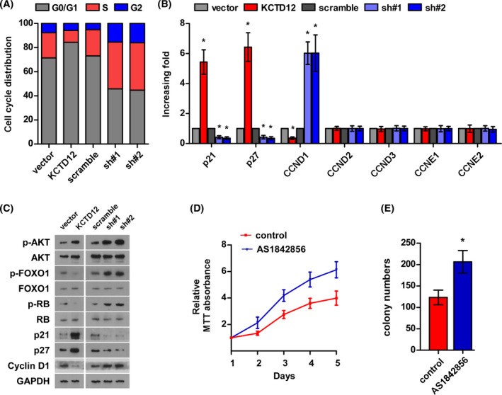 Fig.1 Promotion of breast cancer cell G1/S transition by KCTD12 downregulation. (OA Literature)