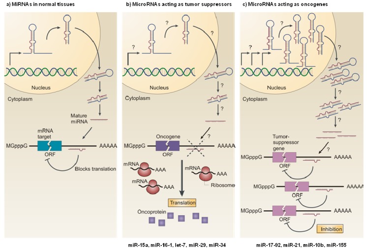 Fig 1. Role of miRNAs in cancer. (OA Literature)