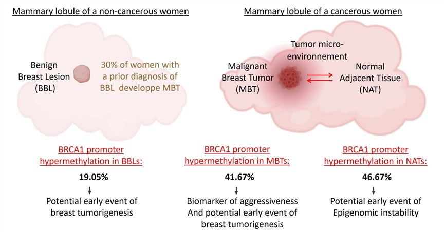 Fig 1. BRCA1 promoter hypermethylation in malignant breast tumors and in the histologically normal adjacent tissues to the tumors. (OA Literature)