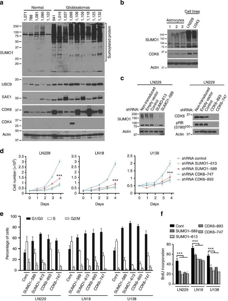 Fig.1 Driving the G1/S transition: A role for SUMO1 conjugation in cell cycle progression. (OA Literature)