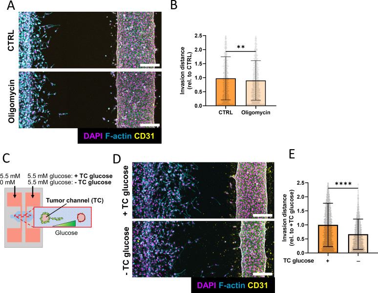 Fig.1 Endothelial-dependent tumor invasion decreases under glucose restriction and ATP synthase inhibition. (OA Literature)