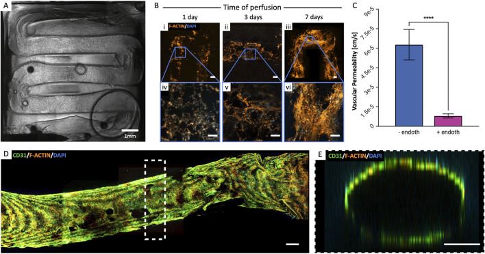 Fig.1 Establishment of endothelial coverage along the vascular channel. (OA Literature)