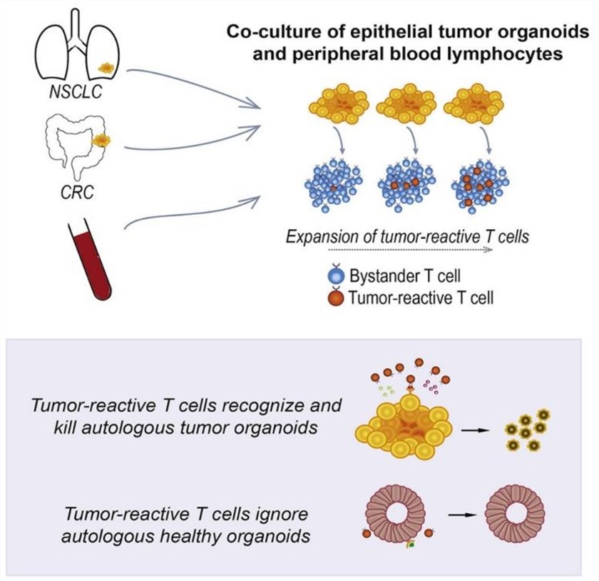 Fig.1 In vitro human cancer models for T cell therapy development. (OA Literature)