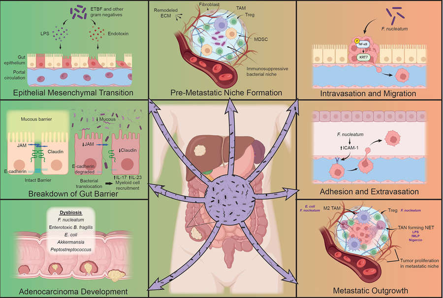 Fig.1 Microbiome is the key driver of tumor metastasis. (OA Literature)