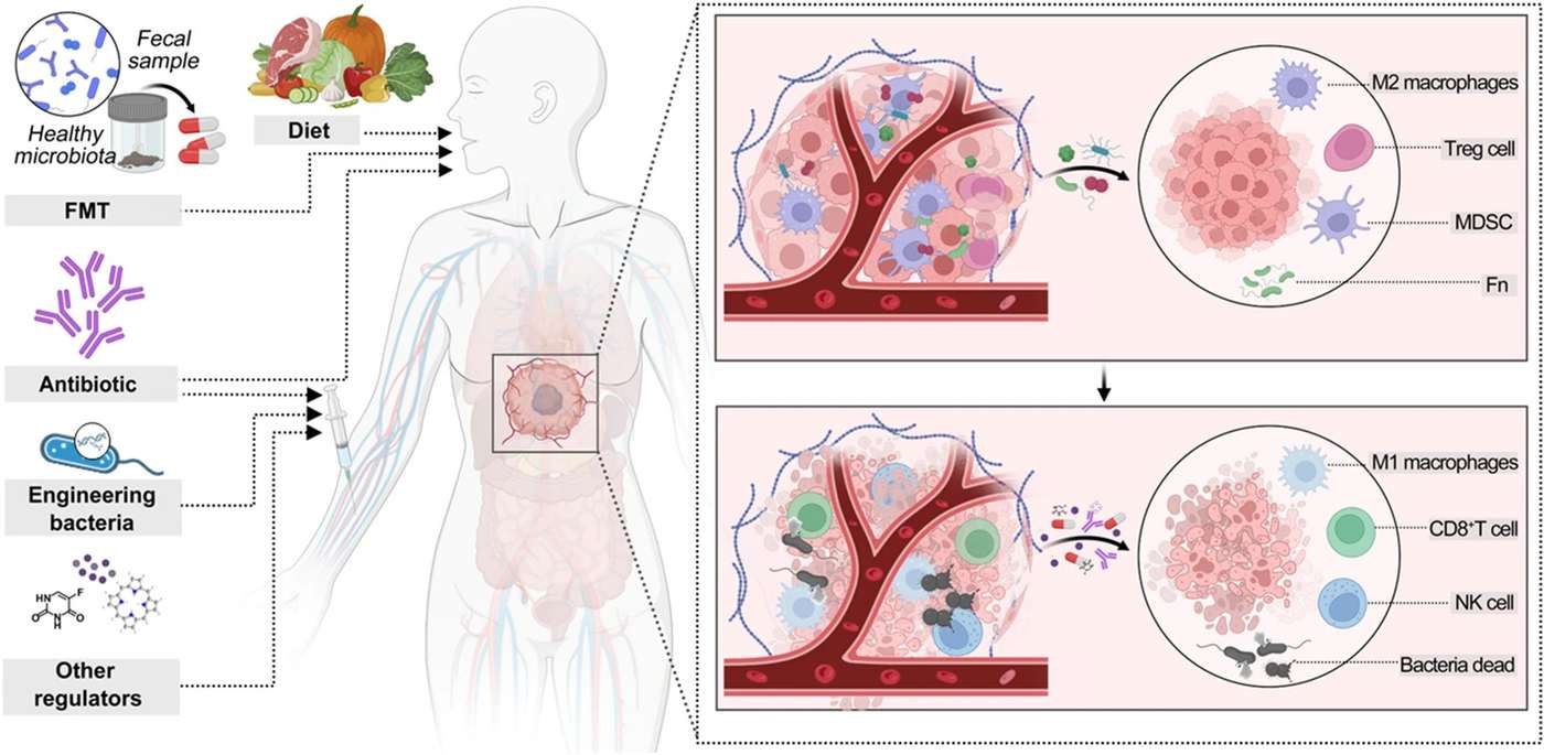 Fig.1 Modulating intratumoral microbiome for enhancing cancer therapy. (OA Literature)
