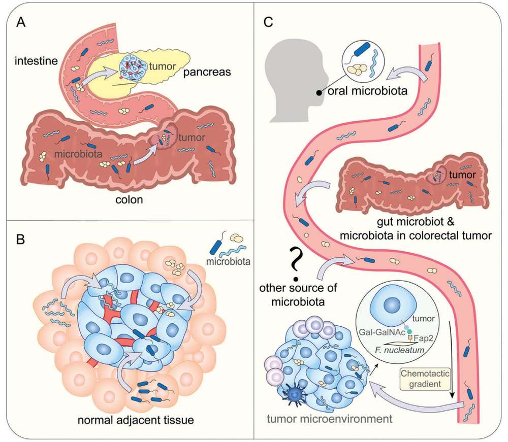 Fig.1 Sources of intratumor microbiota. (OA Literature)