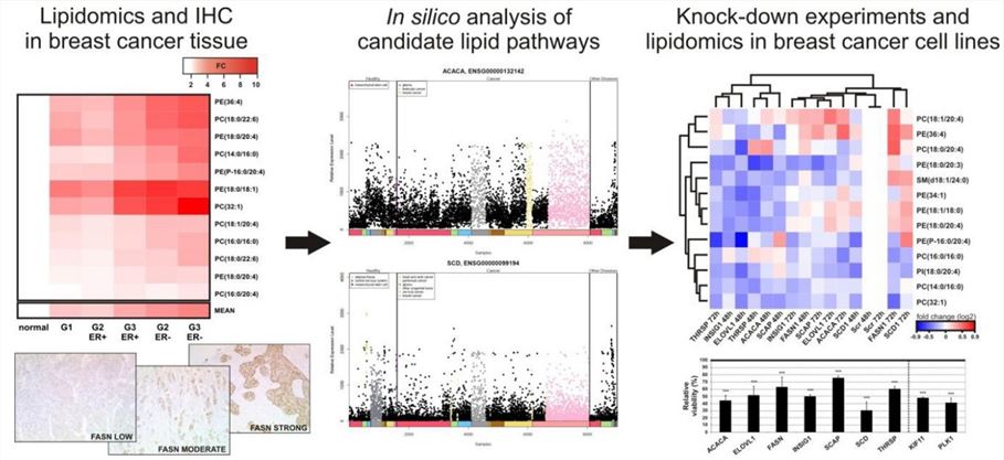 Analysis of lipid metabolism in breast tumors.
