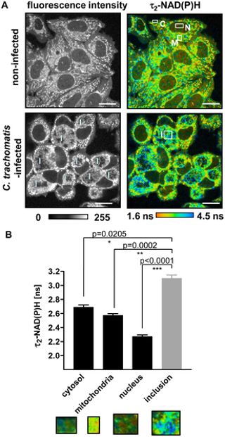 Fig.1 Two-photon microscopy-based FLIM of NAD(P)H.